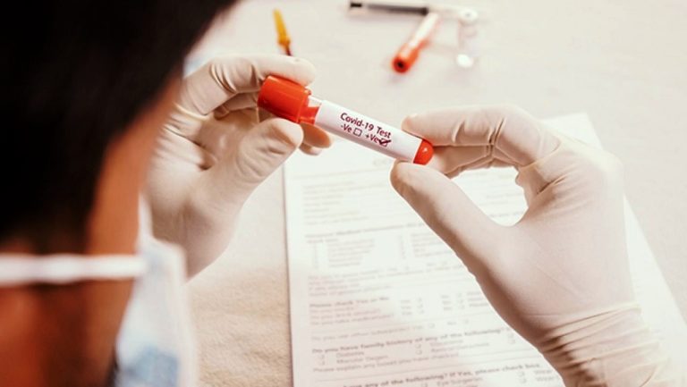 Κέρκυρα: 20 ασθενείς με Covid-19 στη ΜΕΛ – Συνεχίζονται τα rapid test