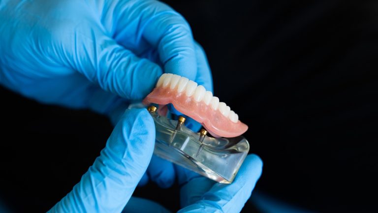 Έρευνα: Οι ασθενείς Covid-19 με μασέλα έχουν περισσότερα επικίνδυνα μικρόβια στο στόμα τους