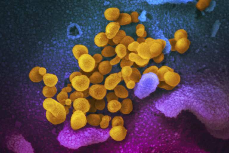 Κορονοϊός: Τα πειράματα «Φρανκενστάιν» με πανδημικούς ιούς διχάζουν τους επιστήμονες
