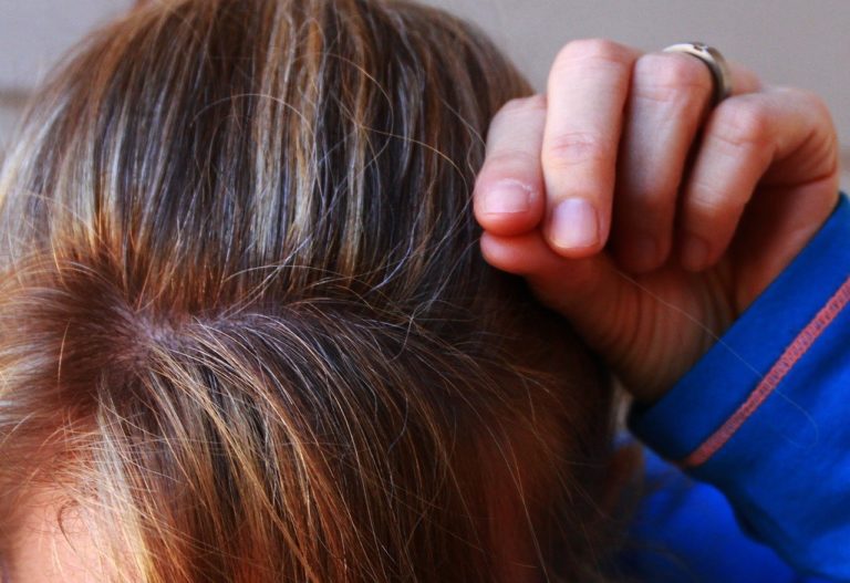 Το γκριζάρισμα των μαλλιών που οφείλεται στο άγχος είναι αναστρέψιμο