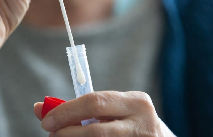 Αχαΐα: Διάθεση των δωρεάν self-tests και από σούπερ μάρκετ