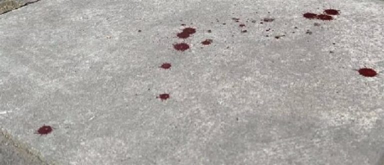 Πυροβολισμός στο κέντρο της Θεσσαλονίκης
