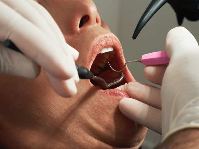 Αντιδράσεις οδοντιάτρων για τα τεστ των ασθενών πριν από την επίσκεψη τους (video)