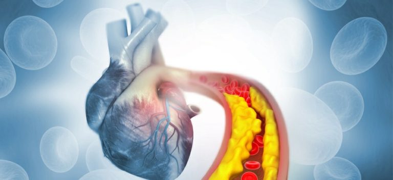 Γονιδιακό φάρμακο που μειώνει τις καρδιακές παθήσεις κατά 50% αρχίζει να χορηγεί το Βρετανικό σύστημα υγείας