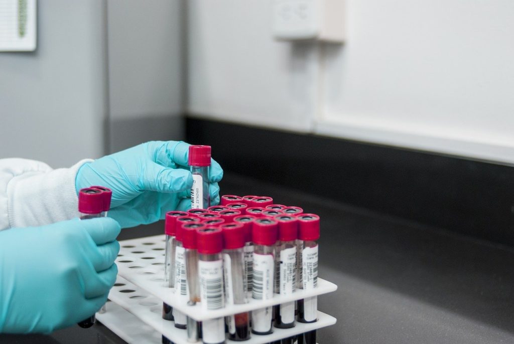 ΗΠΑ: Ένα νέο τεστ αίματος αυτο-αντισωμάτων μπορεί να προβλέψει την πιθανότητα σοβαρής Covid-19