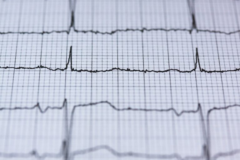 Τεχνητή νοημοσύνη εντοπίζει καρδιακή ανεπάρκεια πριν από την εμφάνιση συμπτωμάτων