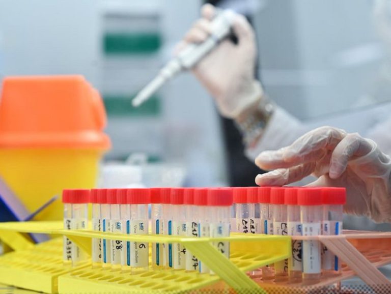 Πανεπιστήμιο Οξφόρδης: Επόμενος στόχος εμβόλιο ειδικά κατά του στελέχους Δέλτα του κορονοϊού