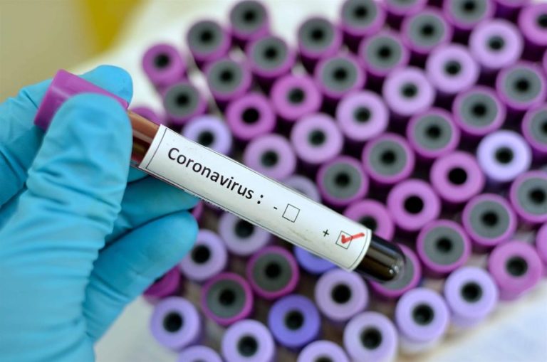 Θεσσαλία: Στις 261 οι νέες μολύνσεις SARS-COV 2 – Αναλυτικοί πίνακες
