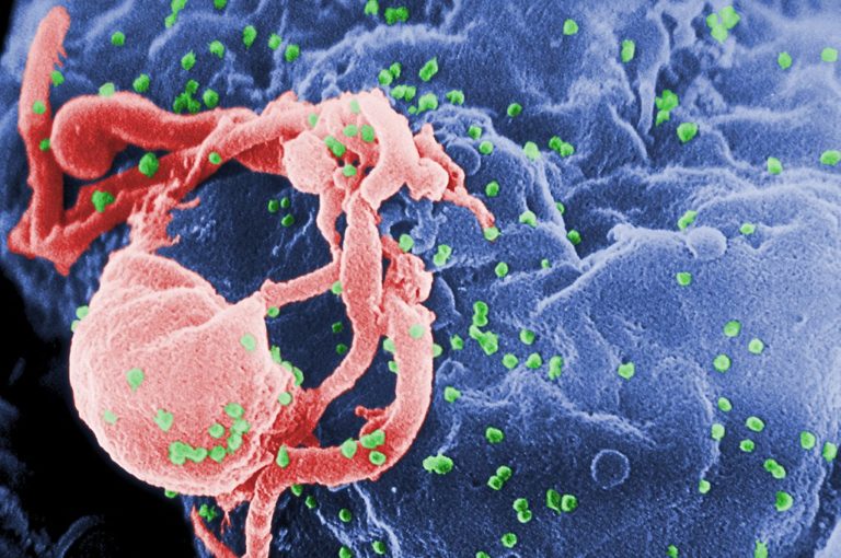 Δεύτερος ασθενής φαίνεται να απαλλάχτηκε τελείως από τον ιό HIV
