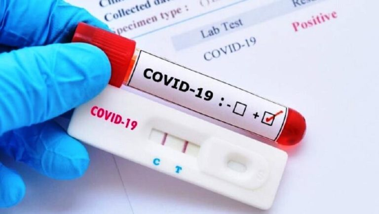Λέσβος: Στα 88 τα νέα κρούσματα covid-19 – Ευρεία σύσκεψη στην Περιφέρεια Βορείου Αιγαίου