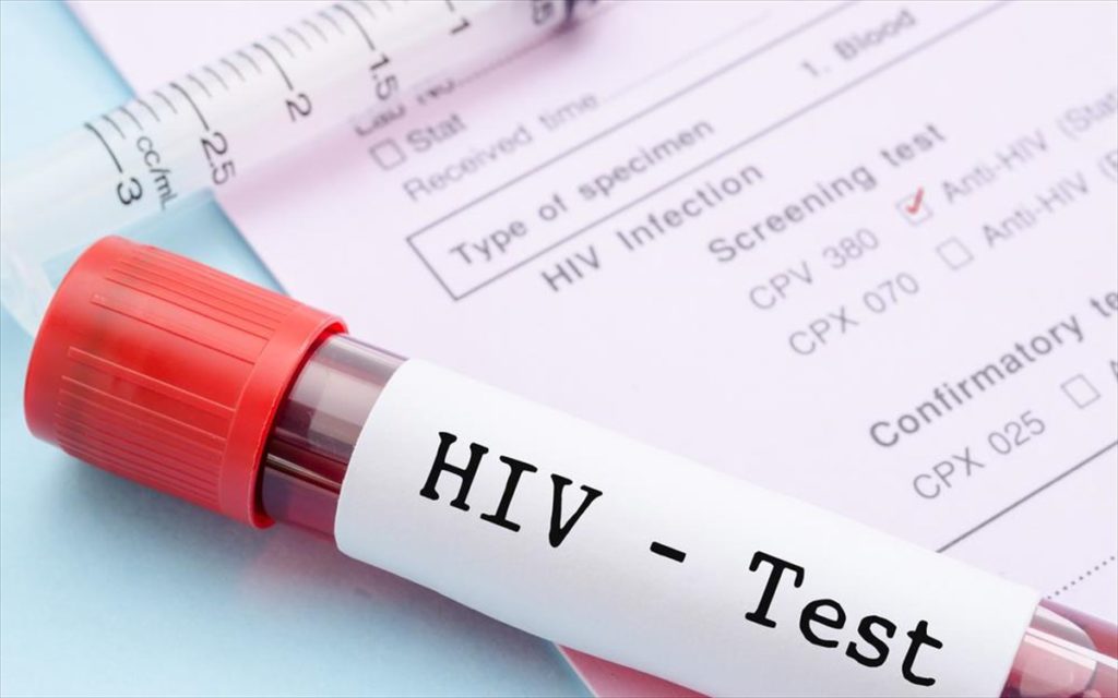 ΠΟΥ-Αφρική: Η καταπολέμηση του ιού HIV επιβραδύνθηκε λόγω της Covid-19