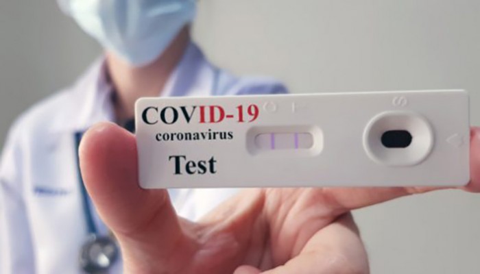 Η Ελλάδα πρώτη στην ΕΕ στα τεστ για τη COVID-19