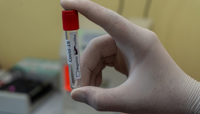 Στα 1.351 τα νέα κρούσματα στην Κρήτη