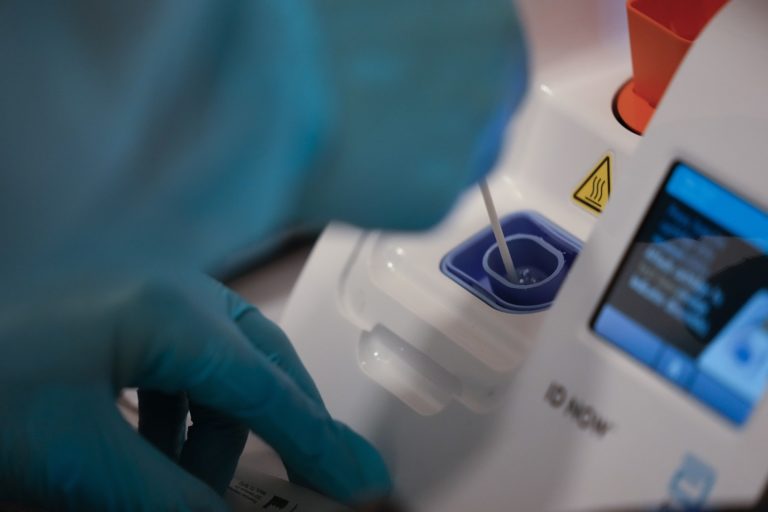 Κοντά στα 50 ευρώ το πλαφόν για PCR test – Σήμερα η ΚΥΑ