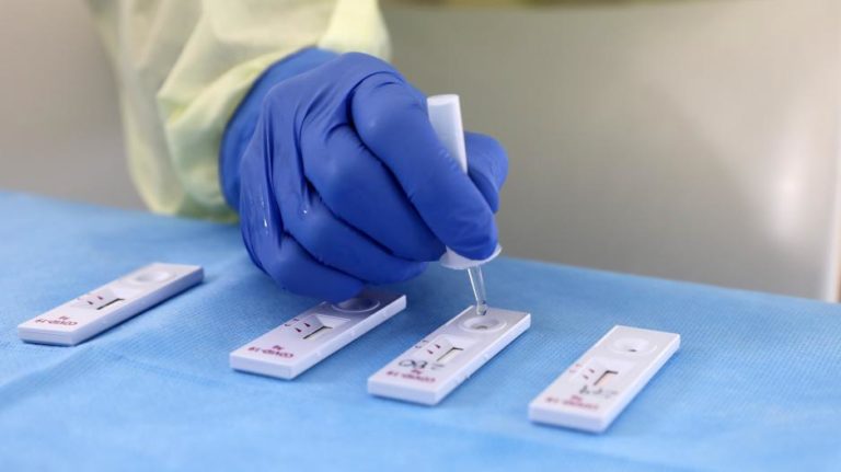 Κορονοϊός: 35 νέοι θάνατοι, 346 διασωληνωμένοι, 16.234 νέα κρούσματα