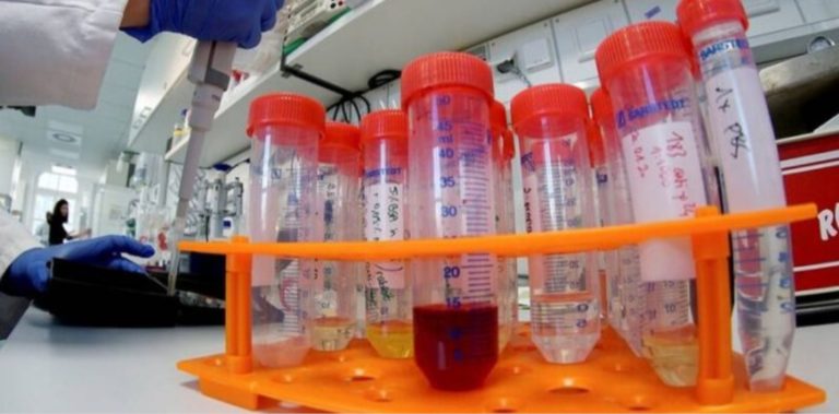 Ιατρικός Σύλλογος Λάρισας: “Χαριστική βολή των εργαστηριακών γιατρών το clawback”