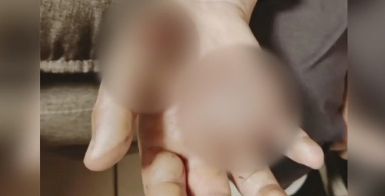 Νέα Σμύρνη: Βίαζε και βασάνιζε τη 10χρονη κόρη του -Την έκαιγε στο “μάτι” της κουζίνας  (video)