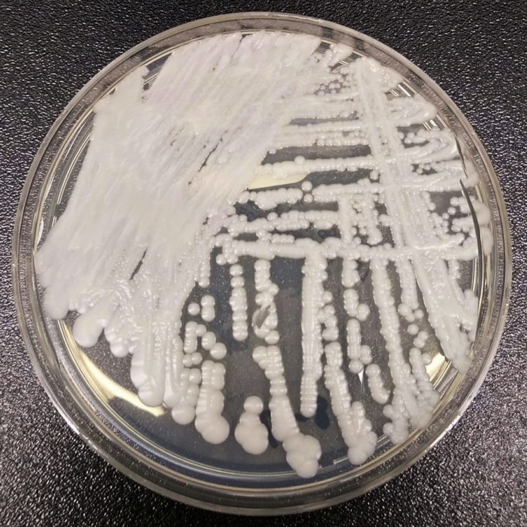 Επικίνδυνος ο μύκητας Candida auris – Ποιά μέτρα προφύλαξης χρειάζονται