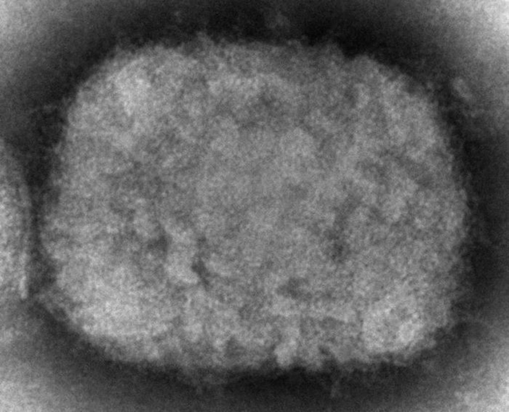 Il vaiolo delle scimmie può trasformarsi in una nuova pandemia?  Cosa sappiamo della malattia?