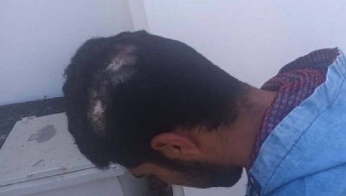 Χανιά: Τη Δευτέρα η δίκη του εργολάβου που ξυλοκόπησε αλλοδαπό εργάτη