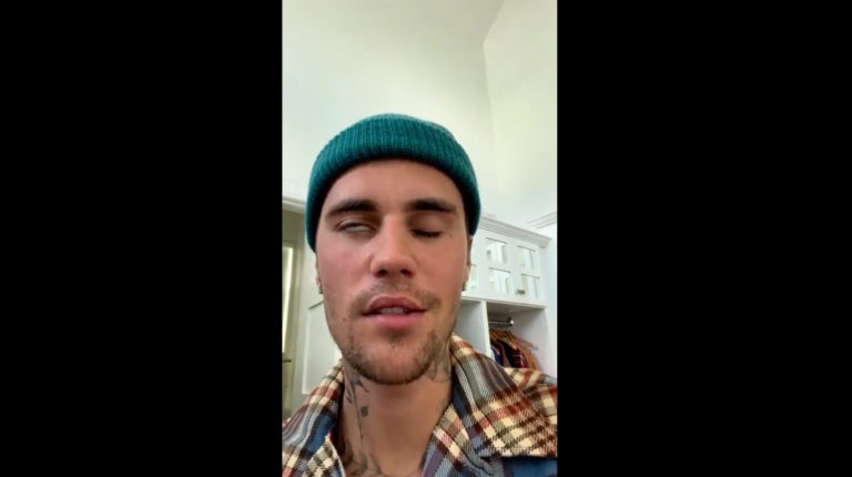 Justin Bieber: Αποκάλυψε ότι έχει παραλύσει το μισό του πρόσωπο (video)