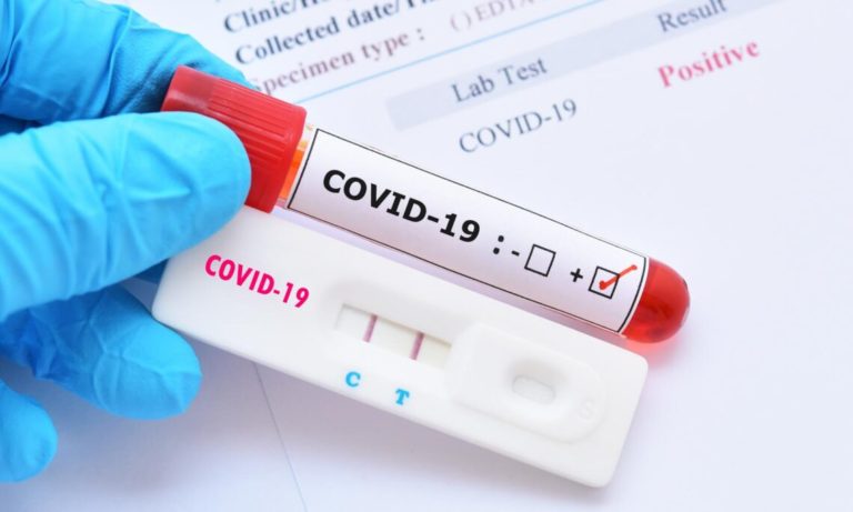 Δωρεάν rapid test Covid-19 για πεζούς στο Δήμο Ωραιοκάστρου 18, 20 & 22 Ιουλίου 2022