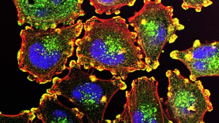 Εμβόλιο mRNA κατά του καρκίνου εξάλειψε τους όγκους σε ποντίκια
