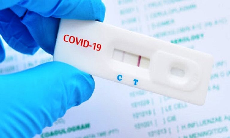 Κορονοϊός: 169 θάνατοι και 135 διασωληνωμένοι – Δύο νέα σοβαρά κρούσματα γρίπης