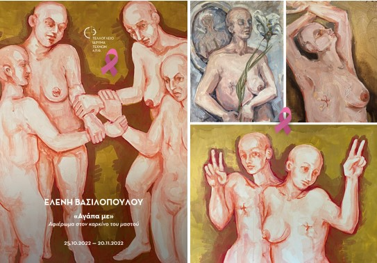 «Αγάπα με»: 39 πίνακες αφιερωμένοι στον καρκίνο του μαστού εκτίθενται στο Τελλόγλειο