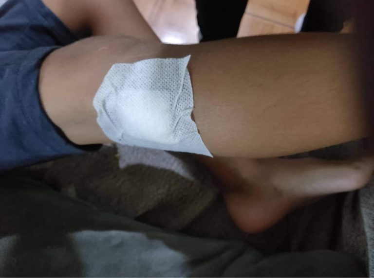 Κέρκυρα: Τραυματίστηκε μαθητής σε σχολείο