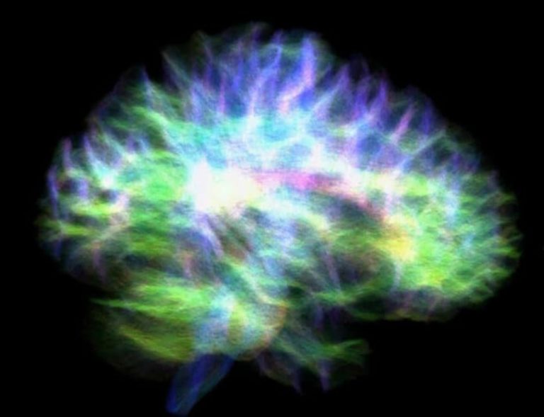 Επιστήμονες δημιούργησαν τον πιο λεπτομερή χάρτη της «τράπεζας» μνήμης του ανθρώπινου εγκεφάλου