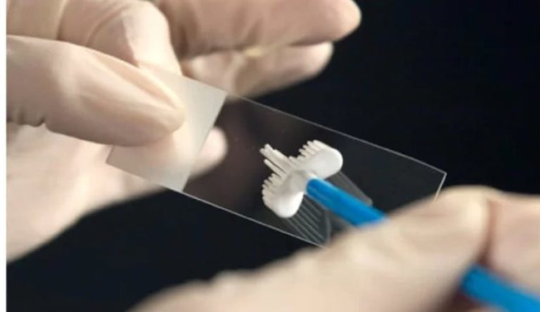 Καβάλα: Δωρεάν εξετάσεις Test Pap από τον Σύλλογο Εθελοντών κατά του Καρκίνου