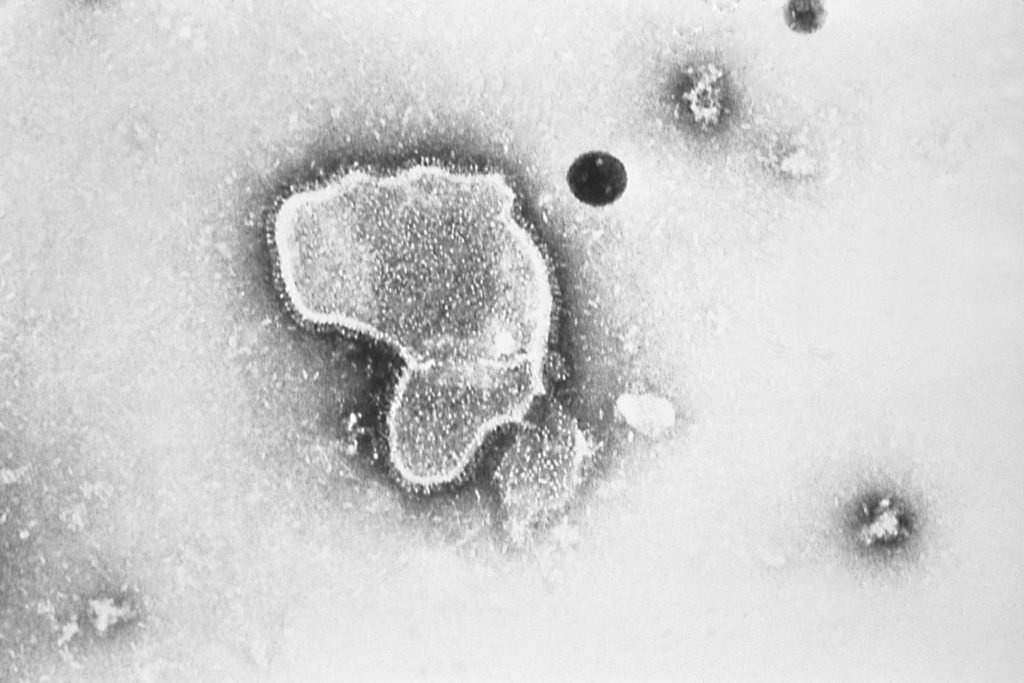 Αναπνευστικός συγκυτιακός ιός (RSV): Για πρώτη φορά το εμβόλιο για μωρά & ηλικιωμένους κατά του επικίνδυνου ιού