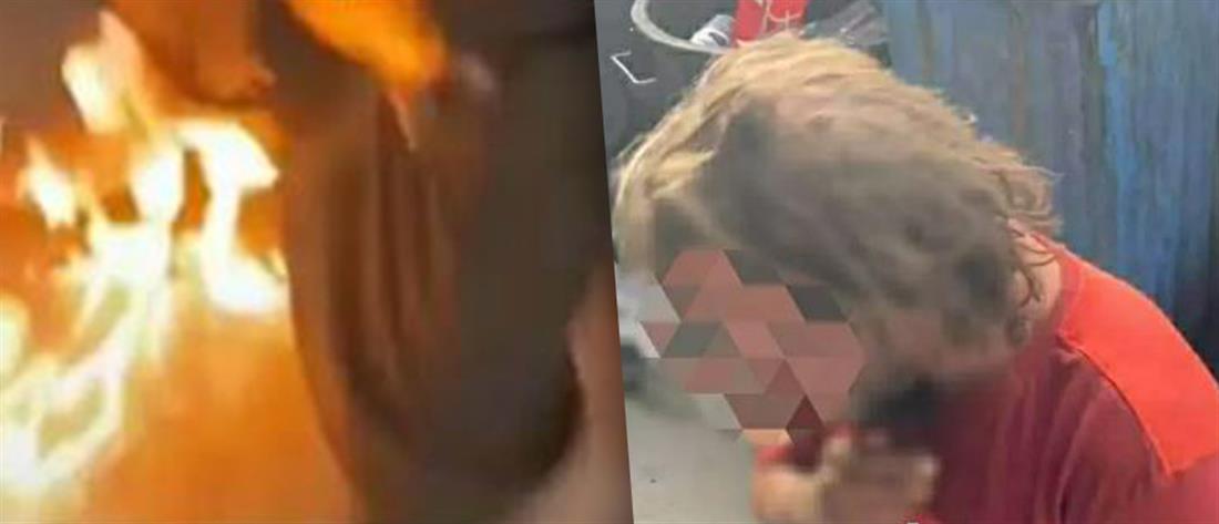 Πάτρα: Ανάγκασαν 35χρονο να πει τα κάλαντα γονατιστός, του έβαλαν φωτιά και τραβούσαν βίντεο