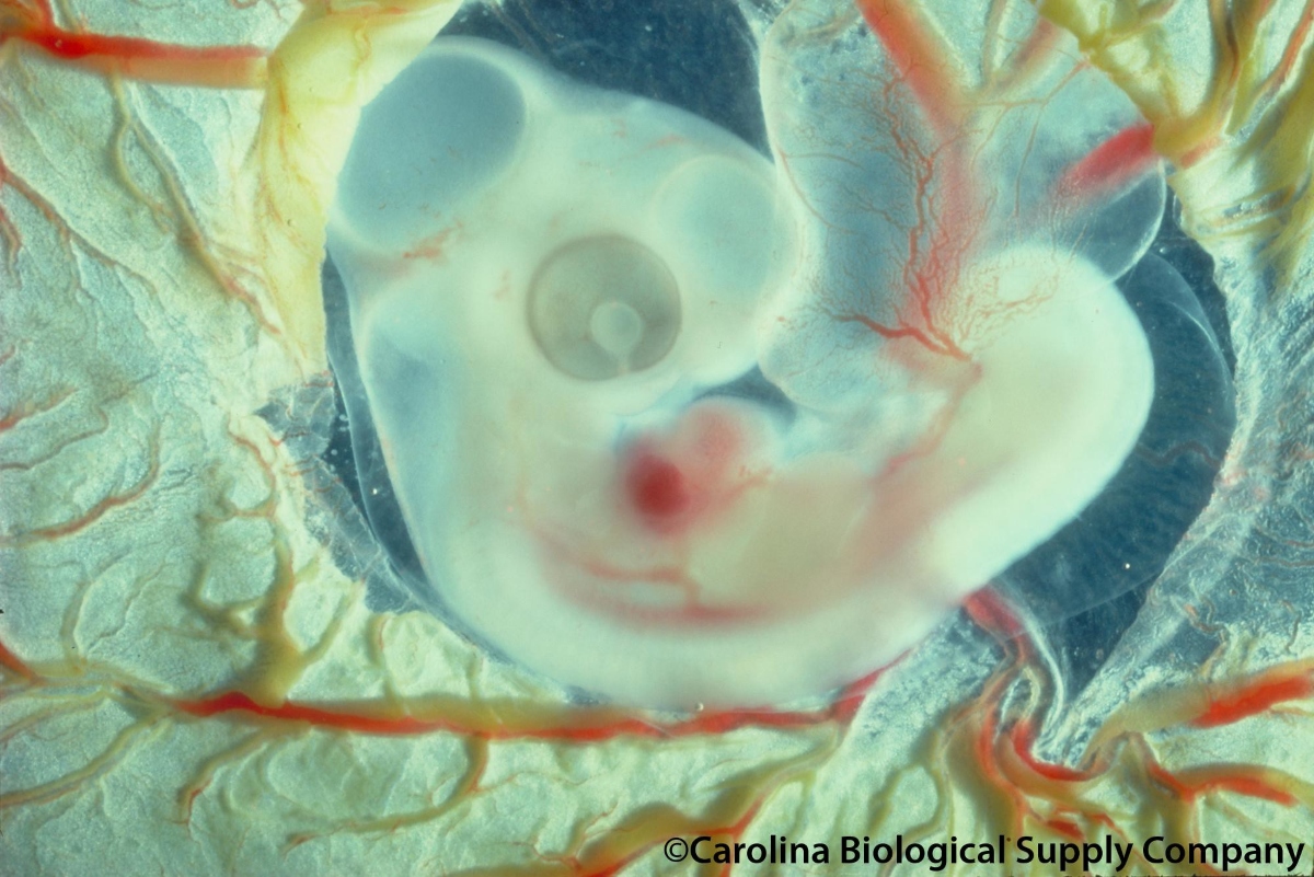 Πώς επηρεάζονται τα έμβρυα από τα νανοπλαστικά- Τι αποκαλύπτει νέα μελέτη