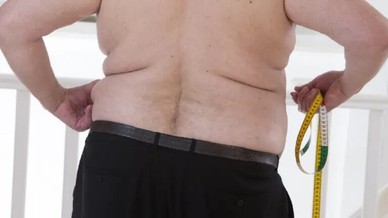 Από τον Ιούνιο ξεκινά το Εθνικό Πρόγραμμα Πρόληψης και Καταπολέμησης Παχυσαρκίας Ενηλίκων – Οι δράσεις του