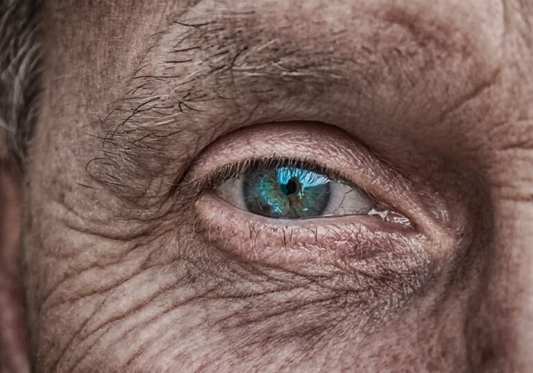 Τα πρώτα σημάδια της νόσου Αλτσχάιμερ μπορεί να εμφανιστούν στα μάτια σας, διαπιστώνει μελέτη