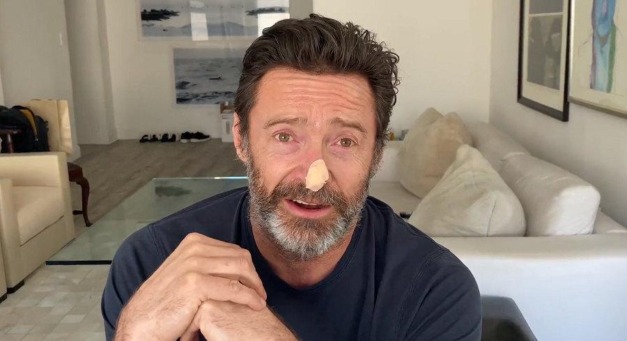 Hugh Jackman