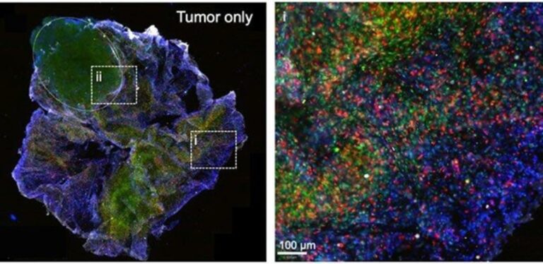 Ερευνητές ανέπτυξαν φορητό τρισδιάστατο βιοεκτυπωτή για την έρευνα του καρκίνου