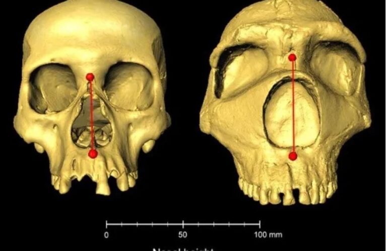 Μια νέα γενετική ανάλυση διαπίστωσε ότι το μέγεθος της μύτης του Νεάντερταλ πέρασε στους σύγχρονους ανθρώπους