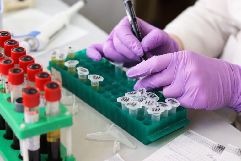 Σε ποια σημεία γίνονται δωρεάν rapid test την Tρίτη 31 Δεκεμβρίου