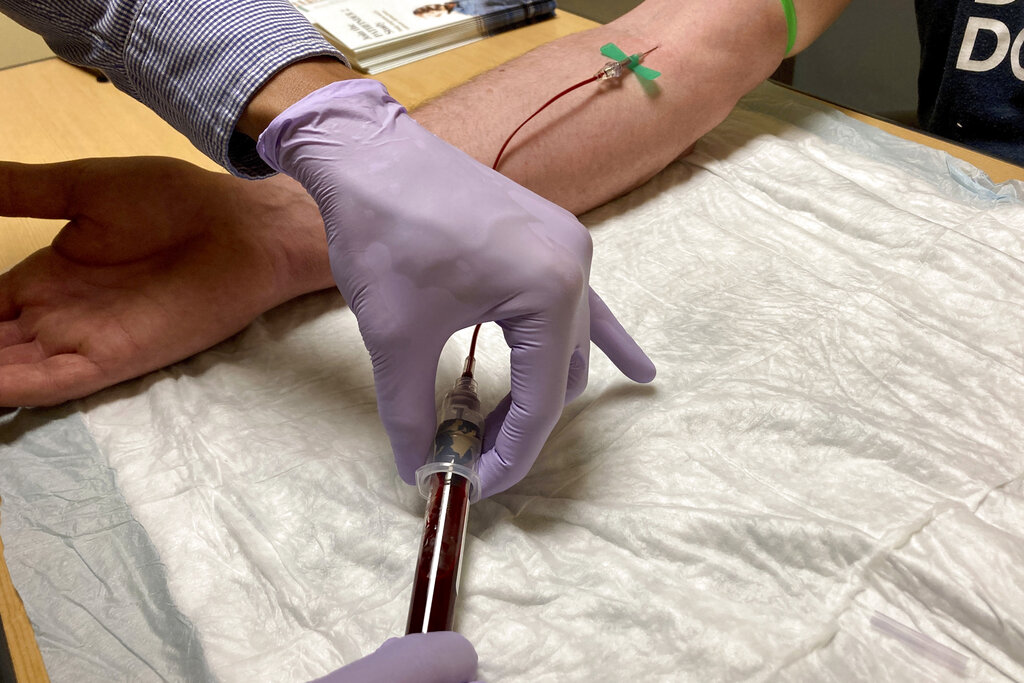 Cancer Blood Test