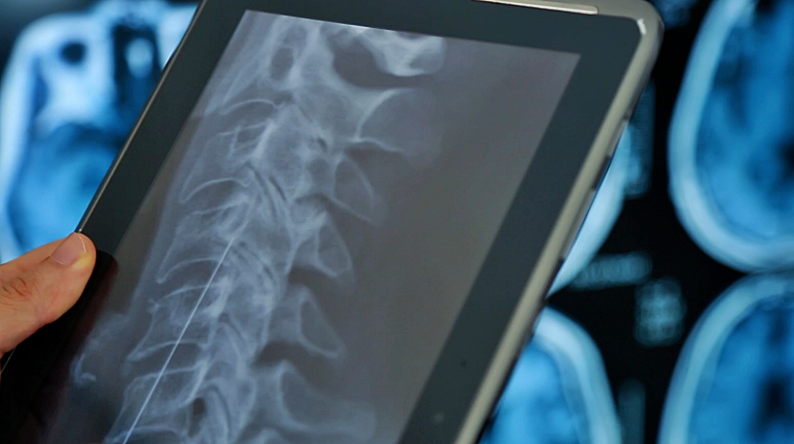 OSTEOPOROSI-SCREENSHOT-ENTHETOYGEIA0506