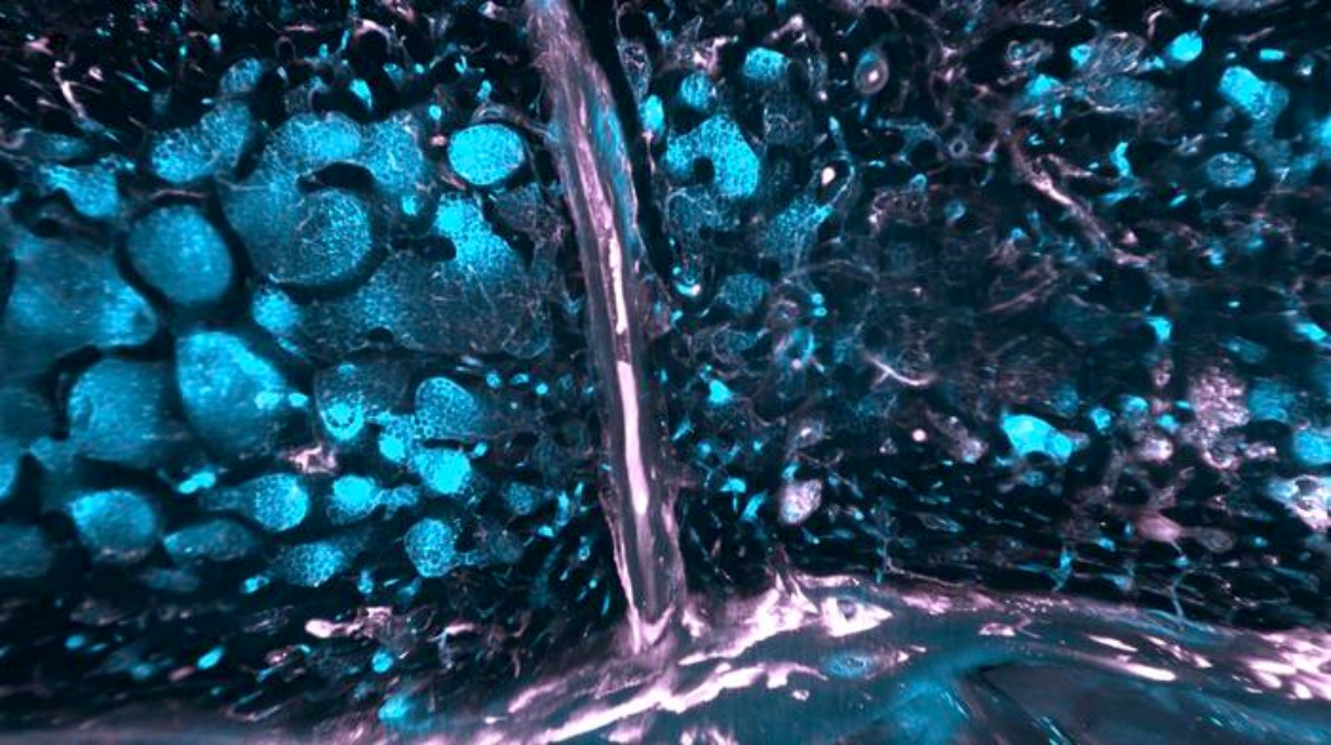 Low-Res_SMCs in human (1)