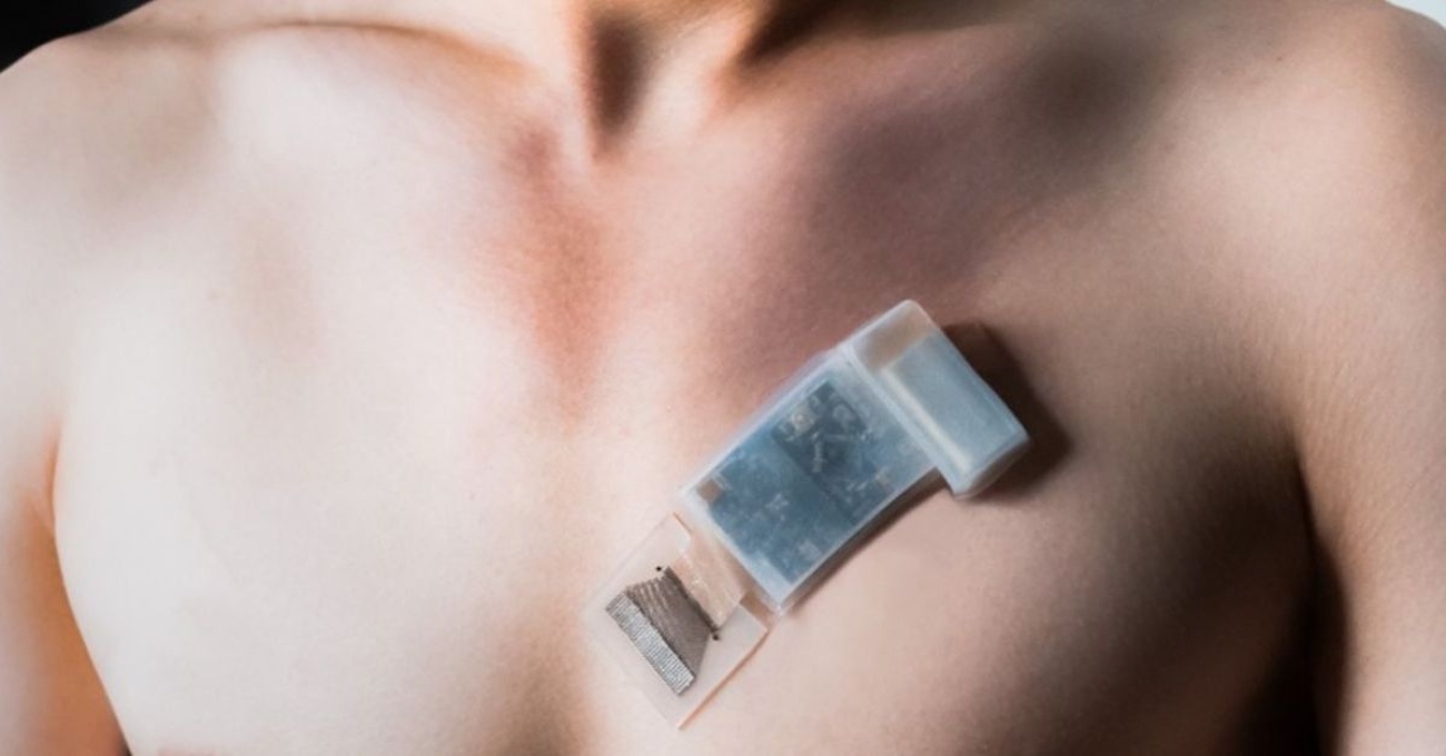 Picture1-_A_wearable_ultrasonic-system-on-patch_mounted_on_the_chest_for_measuring_cardiac_activity._Photo_by_Muyang_Lin_for_the_Jacobs_School_of_Engineering_at_UC_San_Diego_ (1)