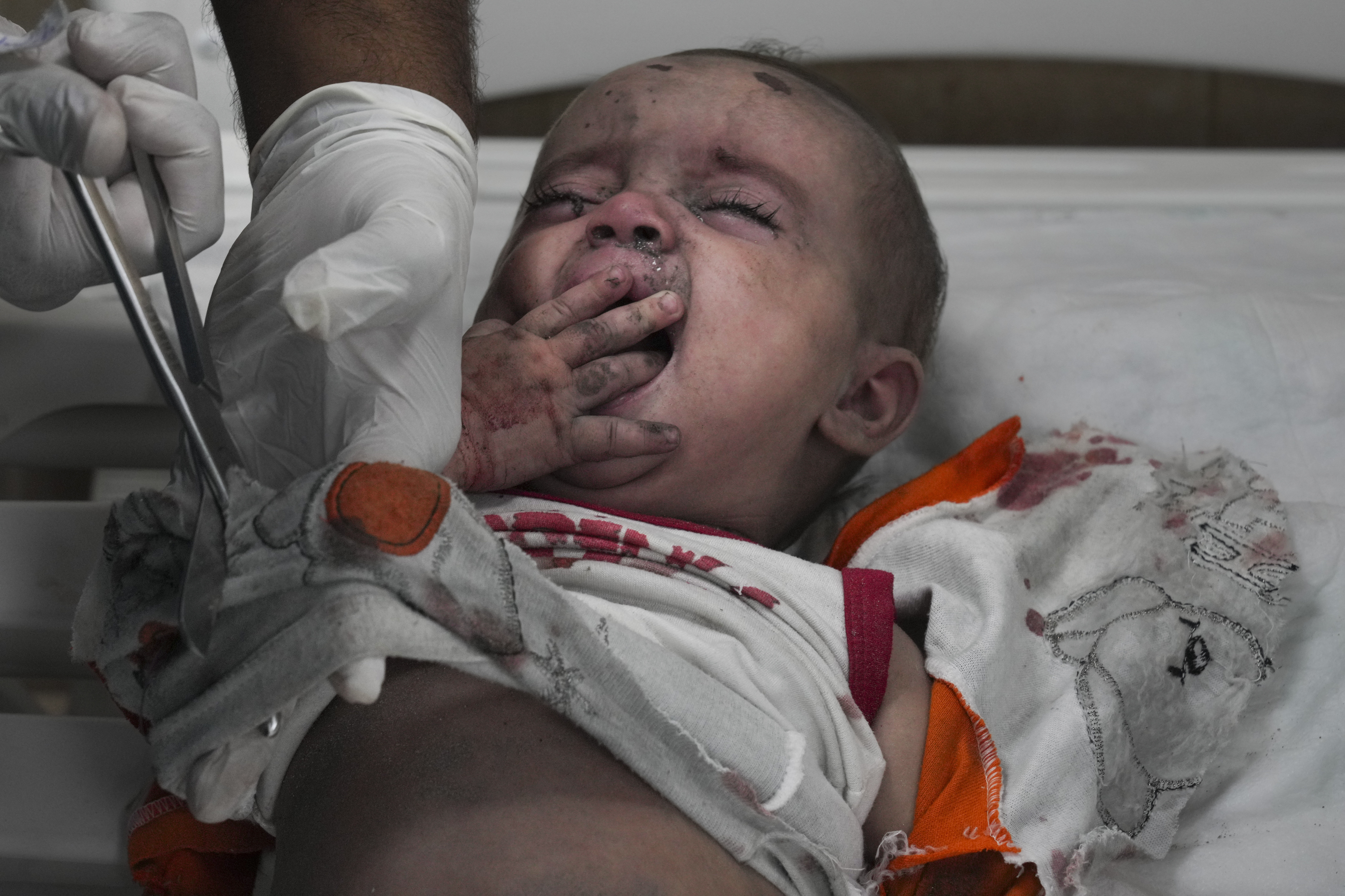 Με λιμό απειλείται η Γάζα, φρίκη στα νοσοκομεία – Η Ελλάδα διερευνά τη δημιουργία θαλάσσιου διαδρόμου για μεταφορά βοήθειας