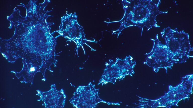 Επιστήμονες εντόπισαν «διακόπτη» που προκαλεί την αυτοκαταστροφή των καρκινικών κυττάρων