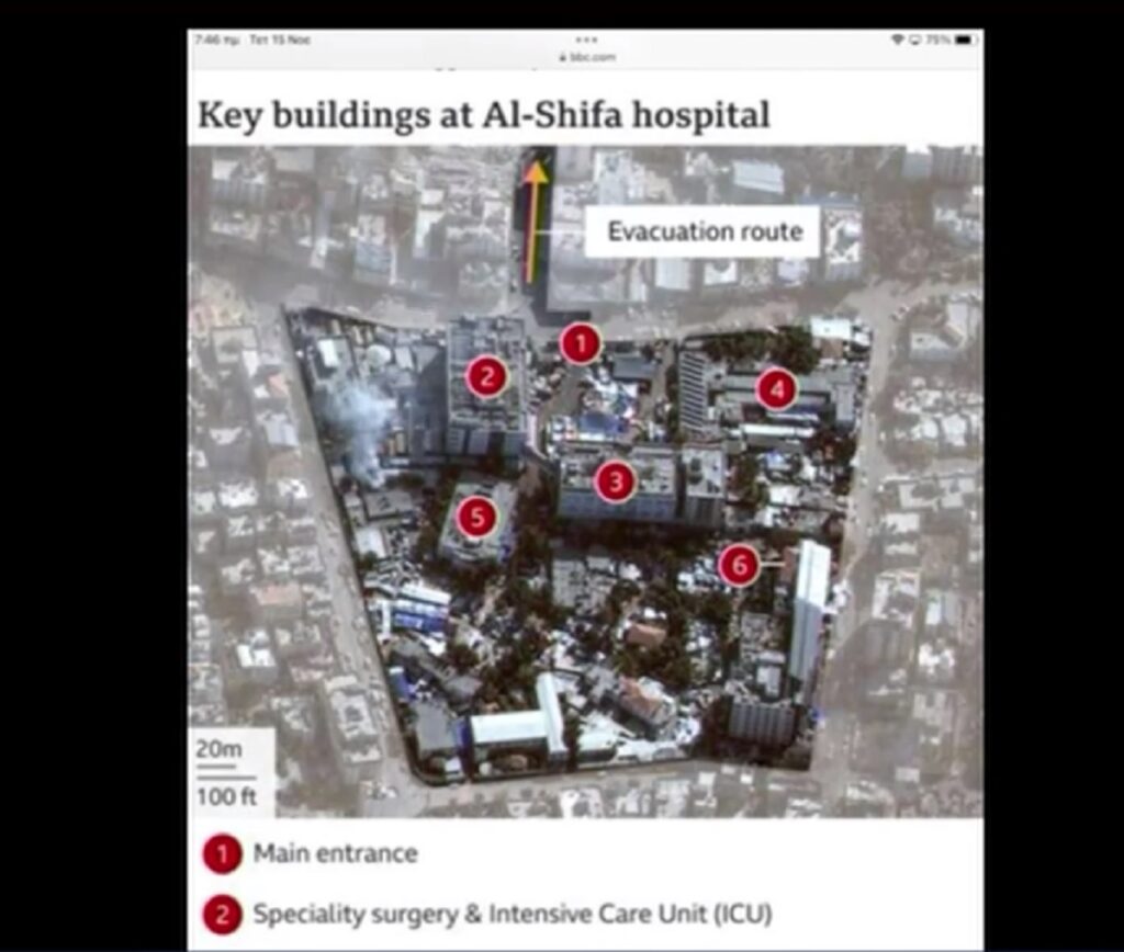 Έφοδος του ισραηλινού στρατού στο νοσοκομείο Αλ Σίφα – Τεθωρακισμένα μπήκαν στο συγκρότημα