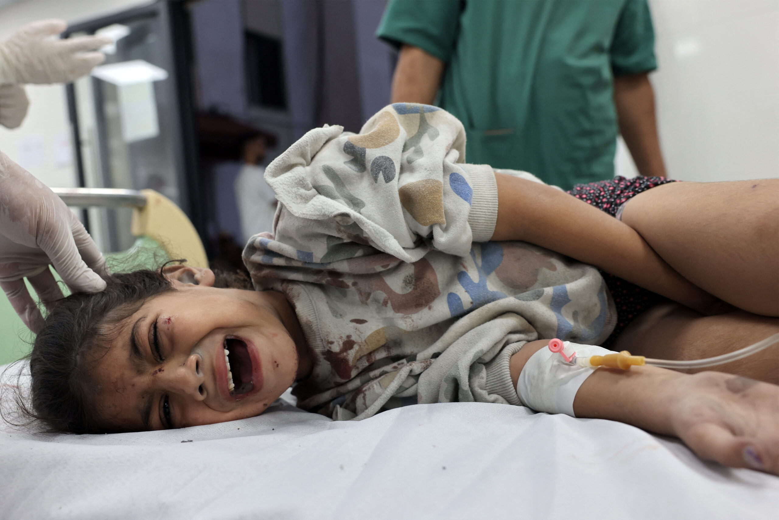 «Μάχη» με τον πόνο στα νοσοκομεία της Γάζας από τις επεμβάσεις χωρίς αναισθησία – «Ο ασθενής θα υποφέρει ή θα χάσει τη ζωή του»
