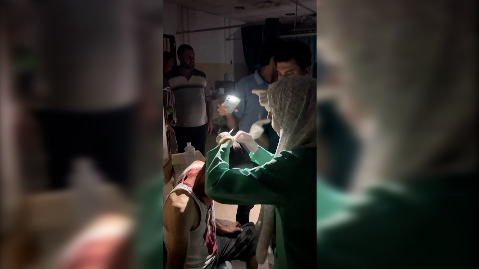 Βίντεο: Προσωπικό νοσοκομείου της Γάζας ράβει τραύμα στο κεφάλι υπό το φως φακού